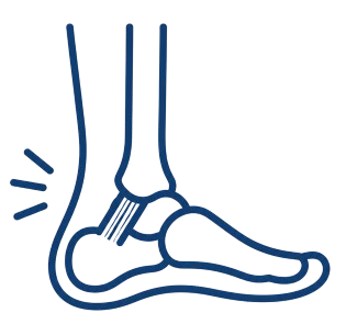 Reconstrução ligamentar do tornozelo